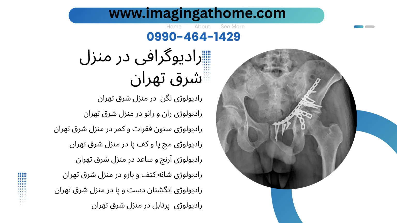 رادیوگرافی در منزل شرق تهران با دستگاه پرتابل؛ انجام تصویربرداری دیجیتال از ریه، قفسه سینه، ستون فقرات، لگن و اندام‌ها در محل بیمار بدون نیاز به جابه‌جایی