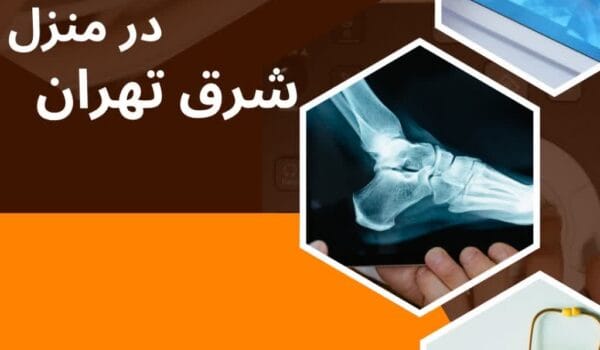 شرق تهران و رادیولوژی پرتابل در منزل