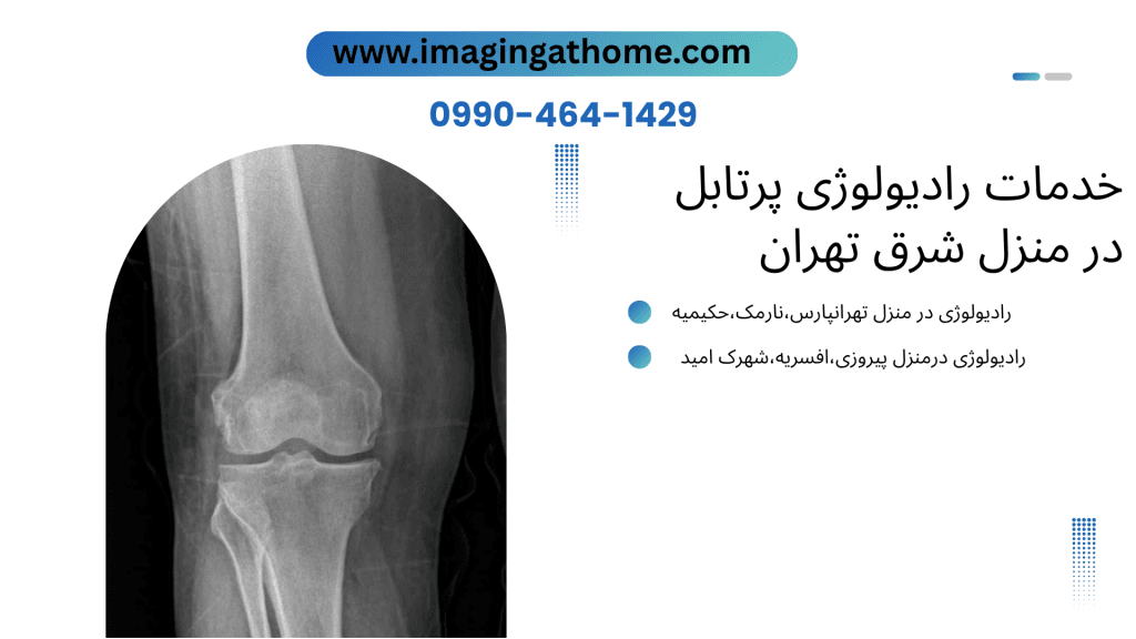 رادیولوژی در منزل شرق تهران رادیولوژی سیار شرق تهران رادیولوژی در منزل تهرانپارس رادیولوژی در منزل نارمک